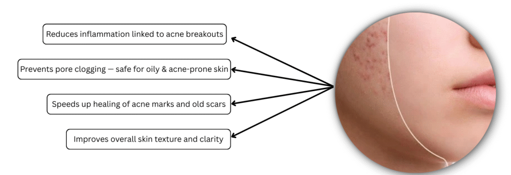 Helps Acne-Prone Skin & Fades Scars