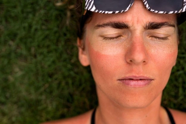 Natural ways to prevent tanning on face