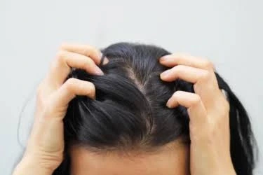 Scalp Health