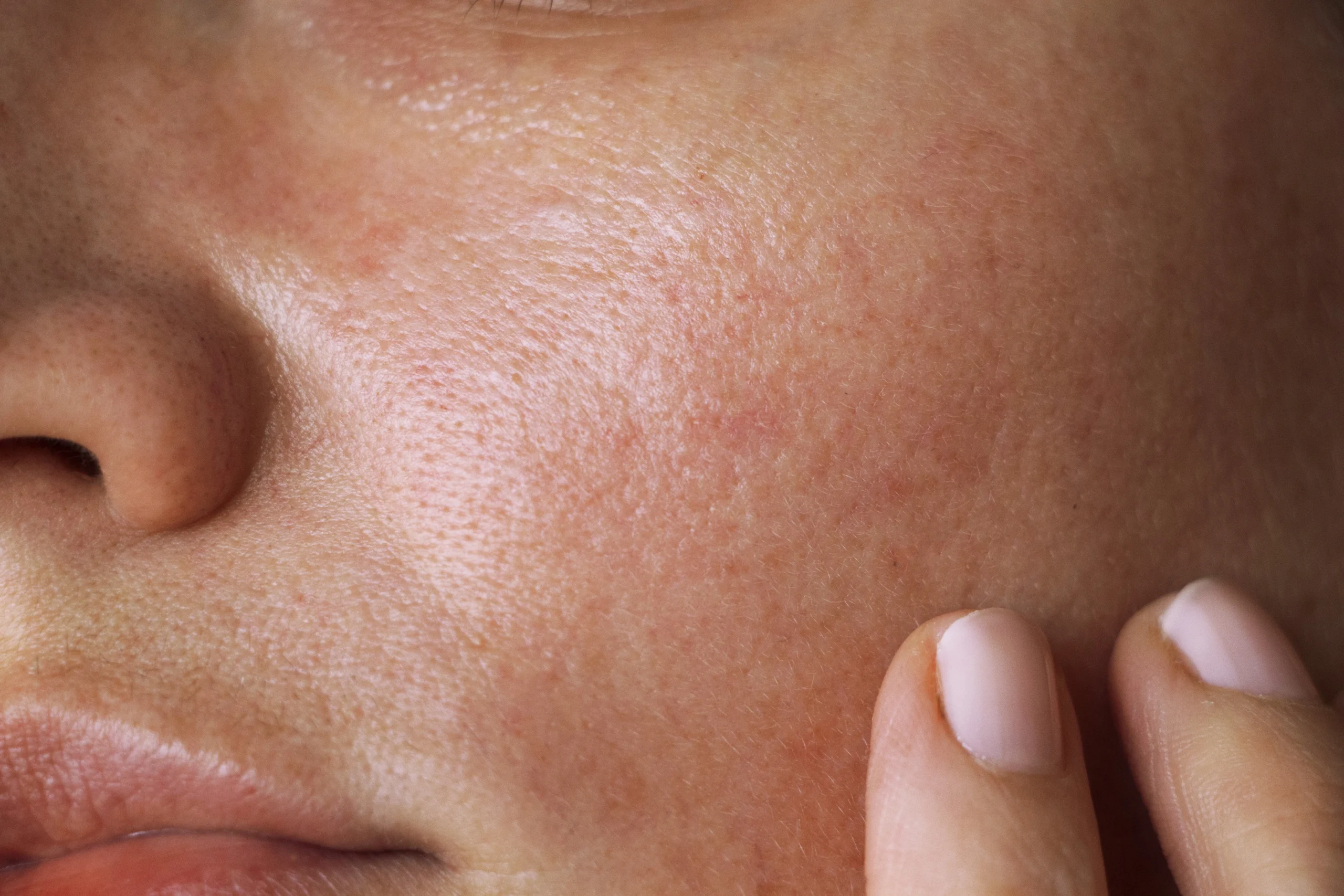 Best Face Creams for Oily Skin