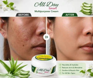 creams for oily skin